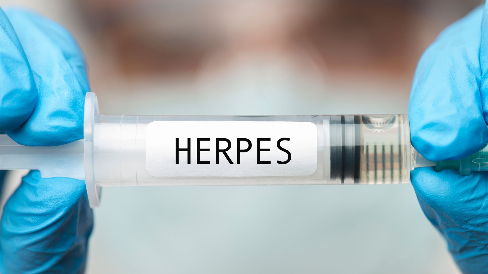 herpes je vírusová infekcia