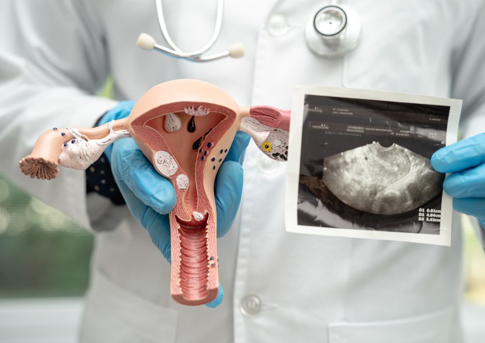 Molárne tehotenstvo(1)